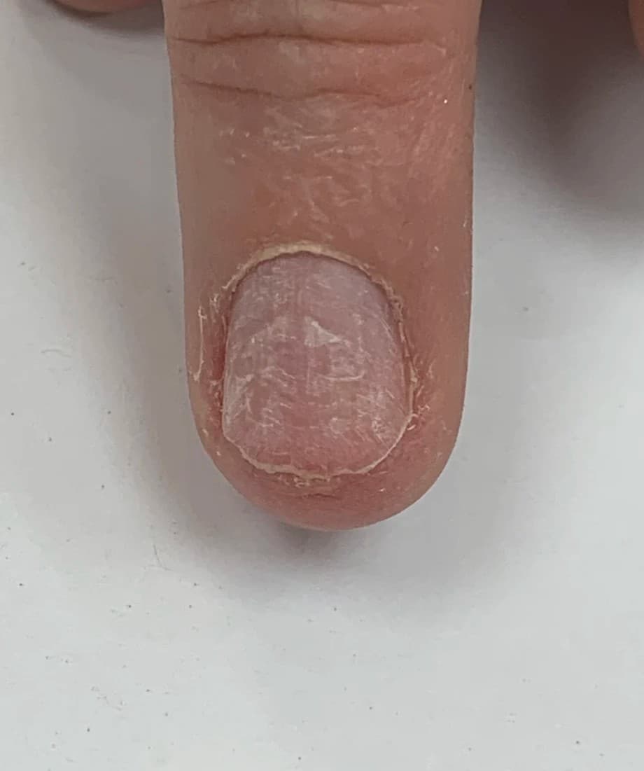 How to Tailor a Nail Form and Create a Ballerina Shape for a Nail Biter